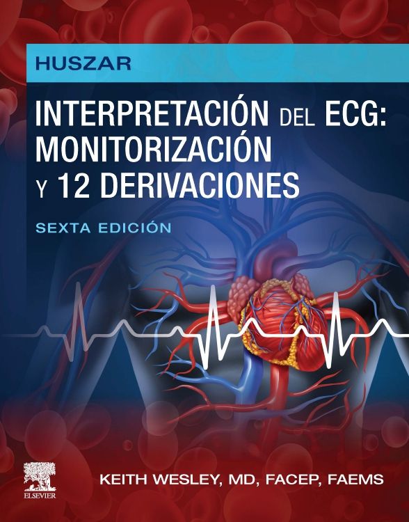 HUSZAR - INTERPRETACION DEL ECG: MONITORIZACIÓN Y 12 DERIVACIONES