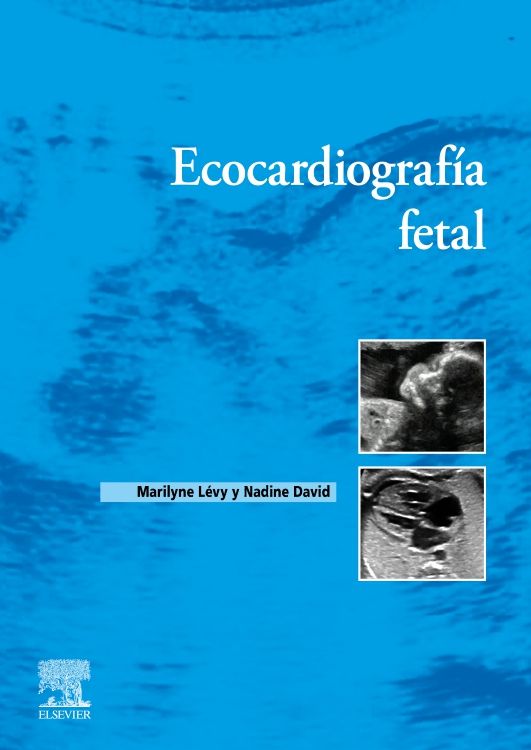 LÉVY - ECOCARDIOGRAFÍA FETAL 1a 2023