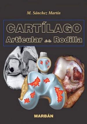 SANCHEZ-CARTILAGO ARTICULAR DE LA RODILLA