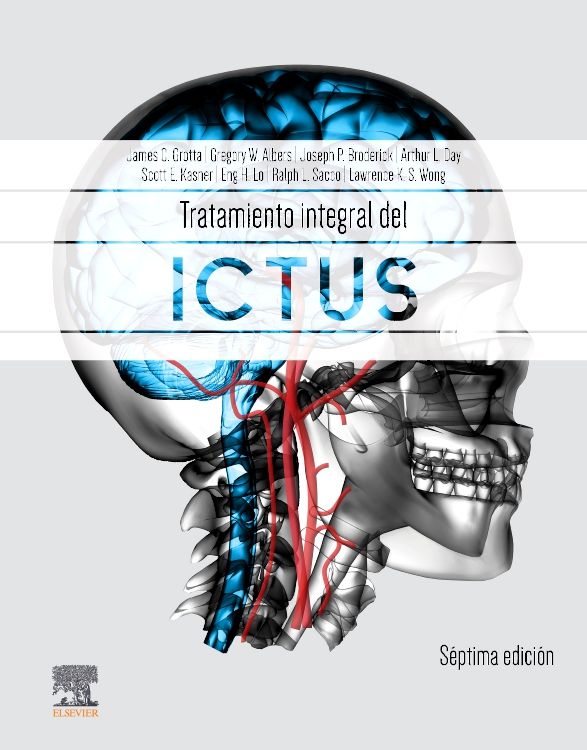 GROTTA - TRATAMIENTO INTEGRAL DEL ICTUS