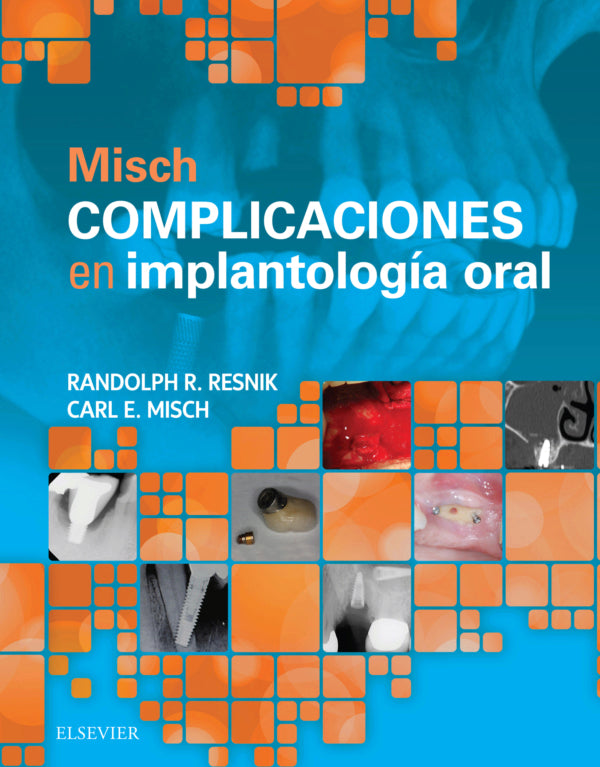 RESNIK, R. R., MISCH. COMPLICACIONES EN IMPLANTOLOGÍA ORAL © 2018