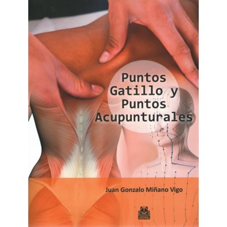 MIÑANO - PUNTOS GATILLO Y PUNTOS ACUPUNTURALES