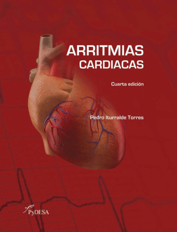 Arritmias Cardiacas