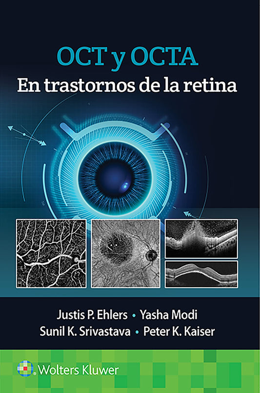 OCT Y OCTA EN TRASTORNOS DE LA RETINA