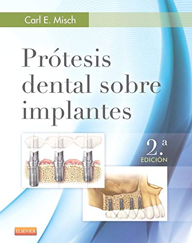 MISCH, C. E., PRÓTESIS DENTAL SOBRE IMPLANTES 2 ED. © 2015 R 2019