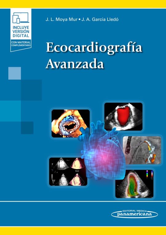 Ecocardiografía Avanzada