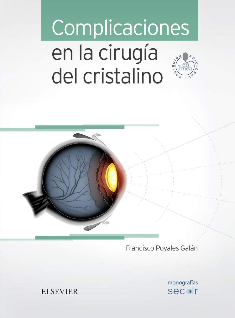 POYALES GALÁN, F., COMPLICACIONES EN LA CIRUGÍA DEL CRISTALINO © 2016