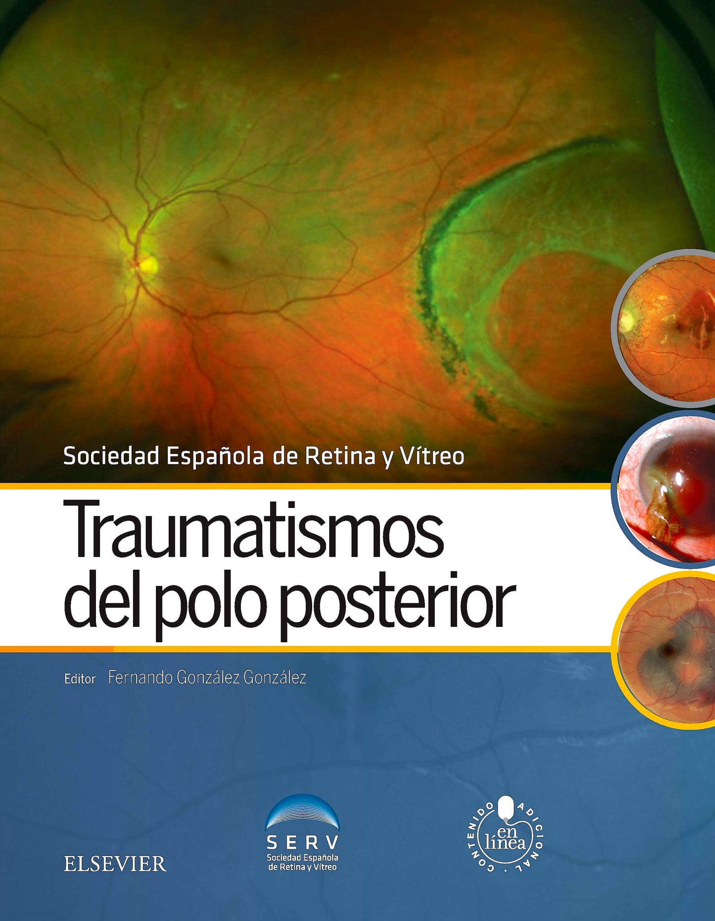 SERV, TRAUMATISMOS DEL POLO POSTERIOR © 2016