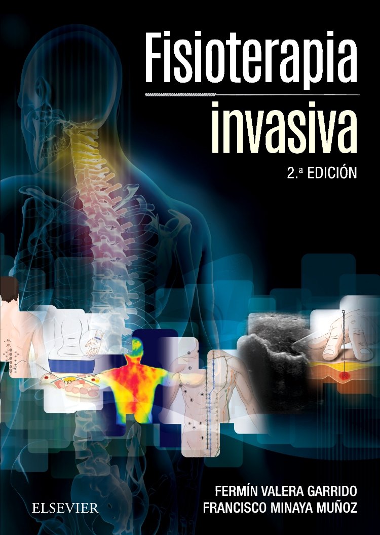 VALERA, F., FISIOTERAPIA INVASIVA 2 ED. © 2016 R 2019