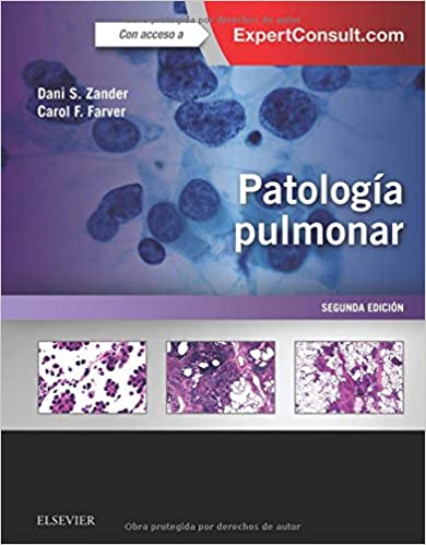 ZANDER, D. S., PATOLOGÍA PULMONAR 2 ED. © 2018