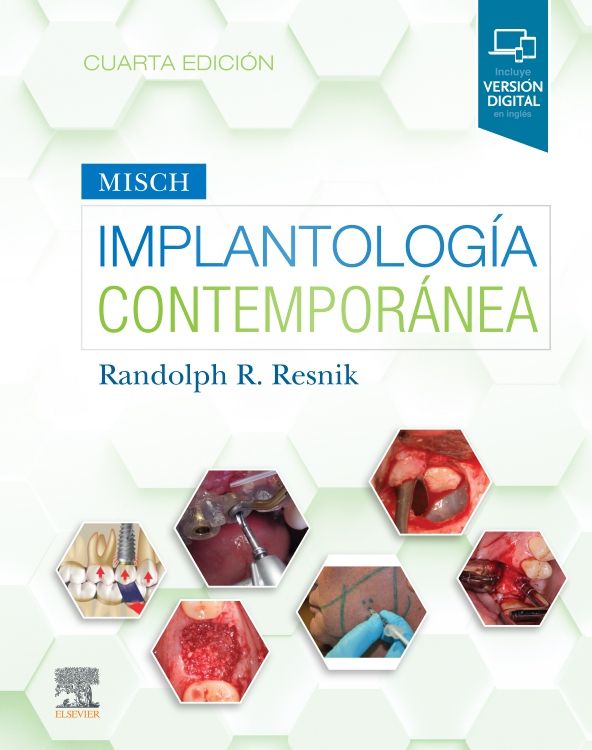 MISCH IMPLANTOLOGÍA CONTEMPORÁNEA