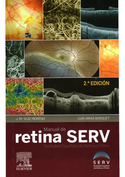 SERV, MANUAL DE RETINA SERV 2 ED. © 2019