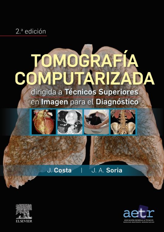 TOMOGRAFÍA COMPUTARIZADA DIRIGIDA A TÉCNICOS SUPERIORES EN IMAGEN PARA EL DIAGNÓSTICO