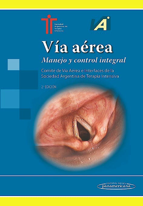 VÍA AÉREA . Manejo y Control Integral