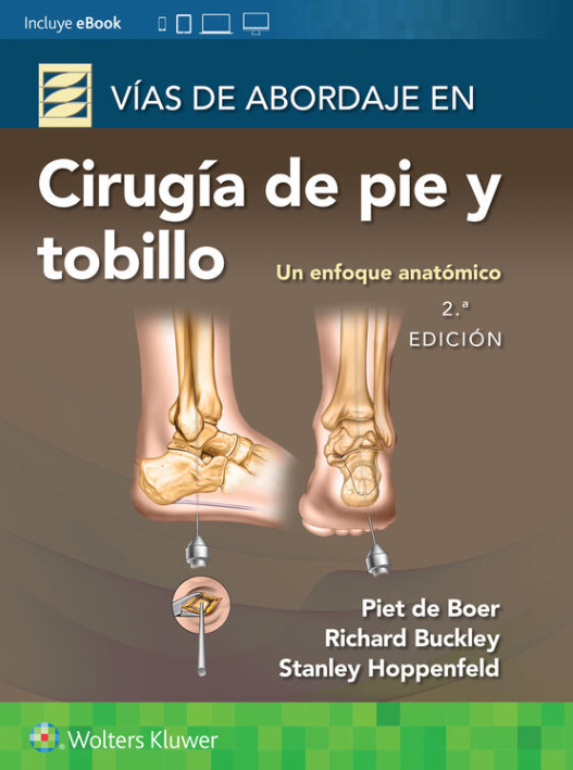 BUCKLEY - VÍAS DE ABORDAJE EN CIRUGÍA DE PIES Y TOBILLO