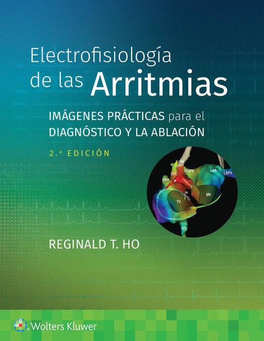 HO - ELECTROFISIOLOGÍA DE LAS ARRITMIAS.