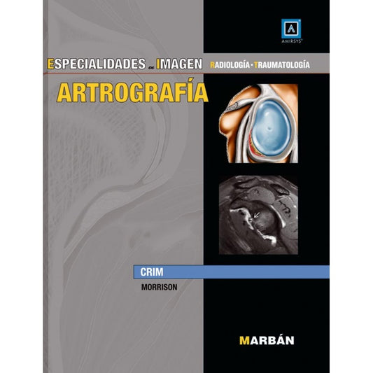 CRIM-ARTROGRAFIA AMIRSYS