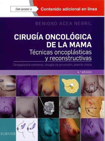 ACEA - CIRUGÍA ONCOLÓGICA DE LA MAMA 4 ED. © 2018