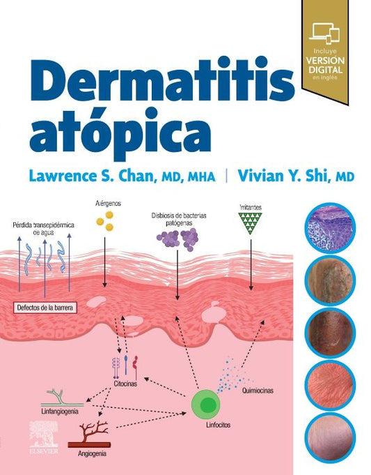 CHAN - DERMATITIS ATÓPICA 1a 2023