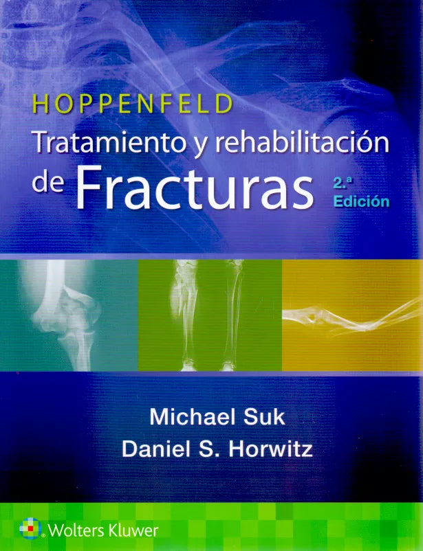 Hoppenfeld. Tratamiento y rehabilitación de fracturas 2A ED