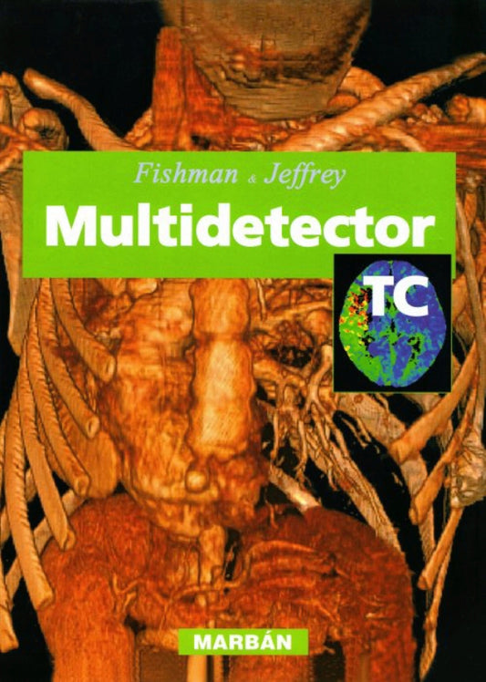 FISHMAN &-MULTIDETECTOR