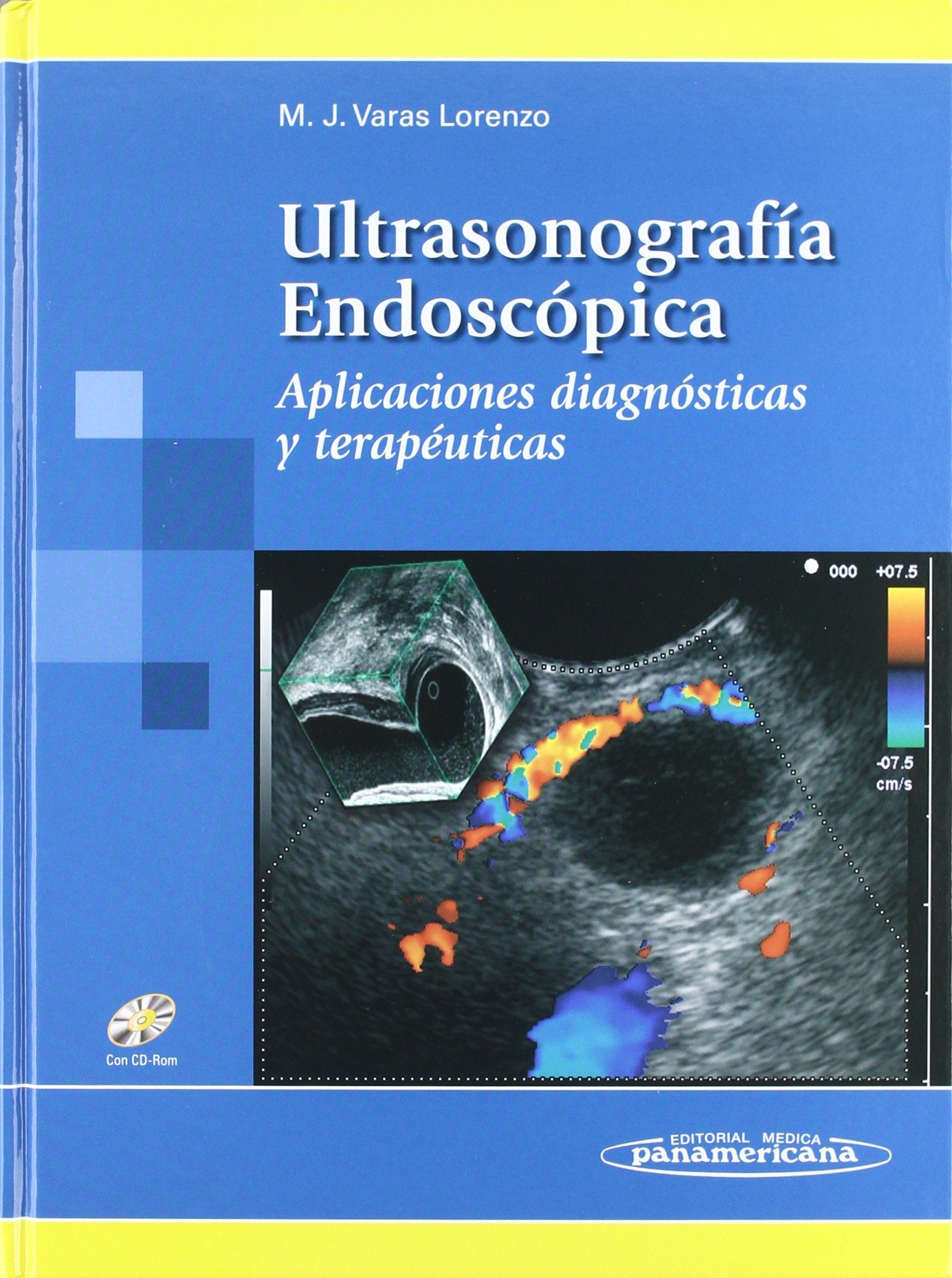 ULTRASONOGRAFIA ENDOSCOPICA : aplicaciones diagnósticas y terapéuticas