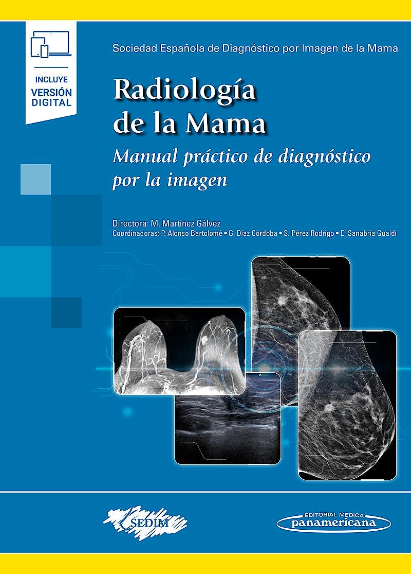 RADIOLOGIA DE LA MAMA. Manual Práctico de Diagnóstico por la Imagen