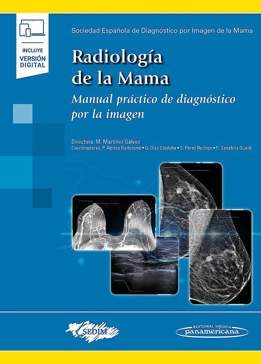 RADIOLOGIA DE LA MAMA. Manual Práctico de Diagnóstico por la Imagen
