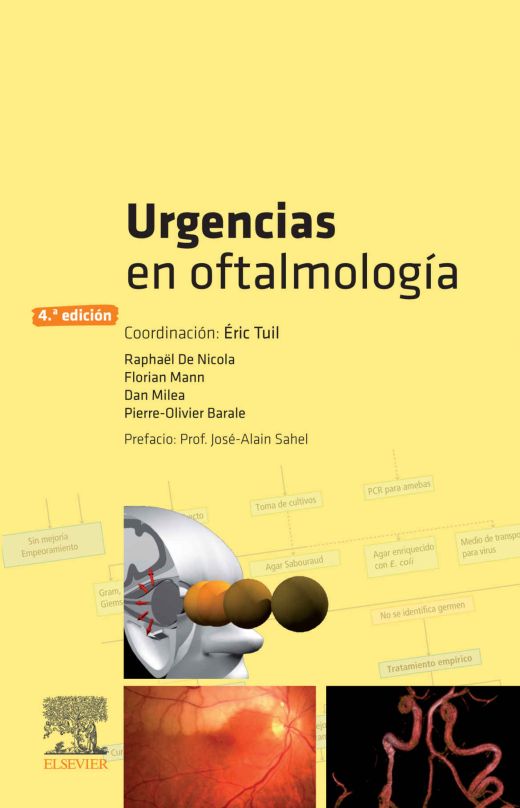 TUIL, E., URGENCIAS EN OFTALMOLOGÍA 4 ED. © 2019 R 2020