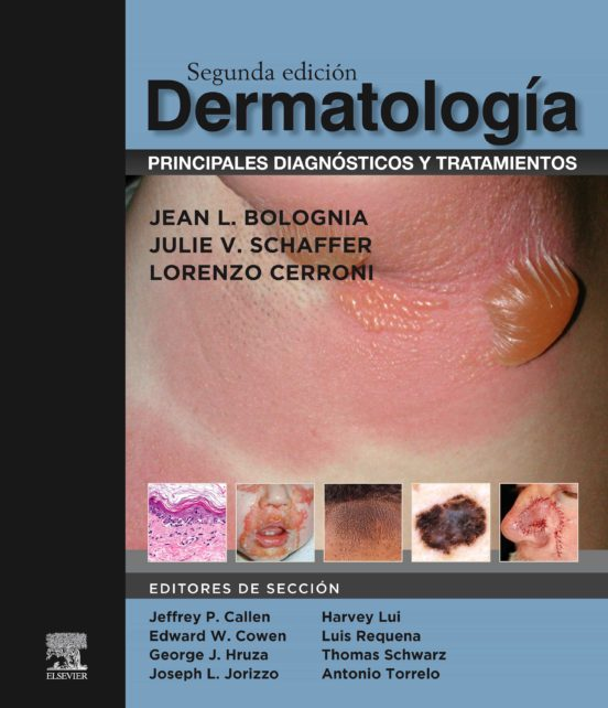 Dermatología: principales diagnósticos y tratamientos